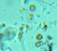 needle lichen